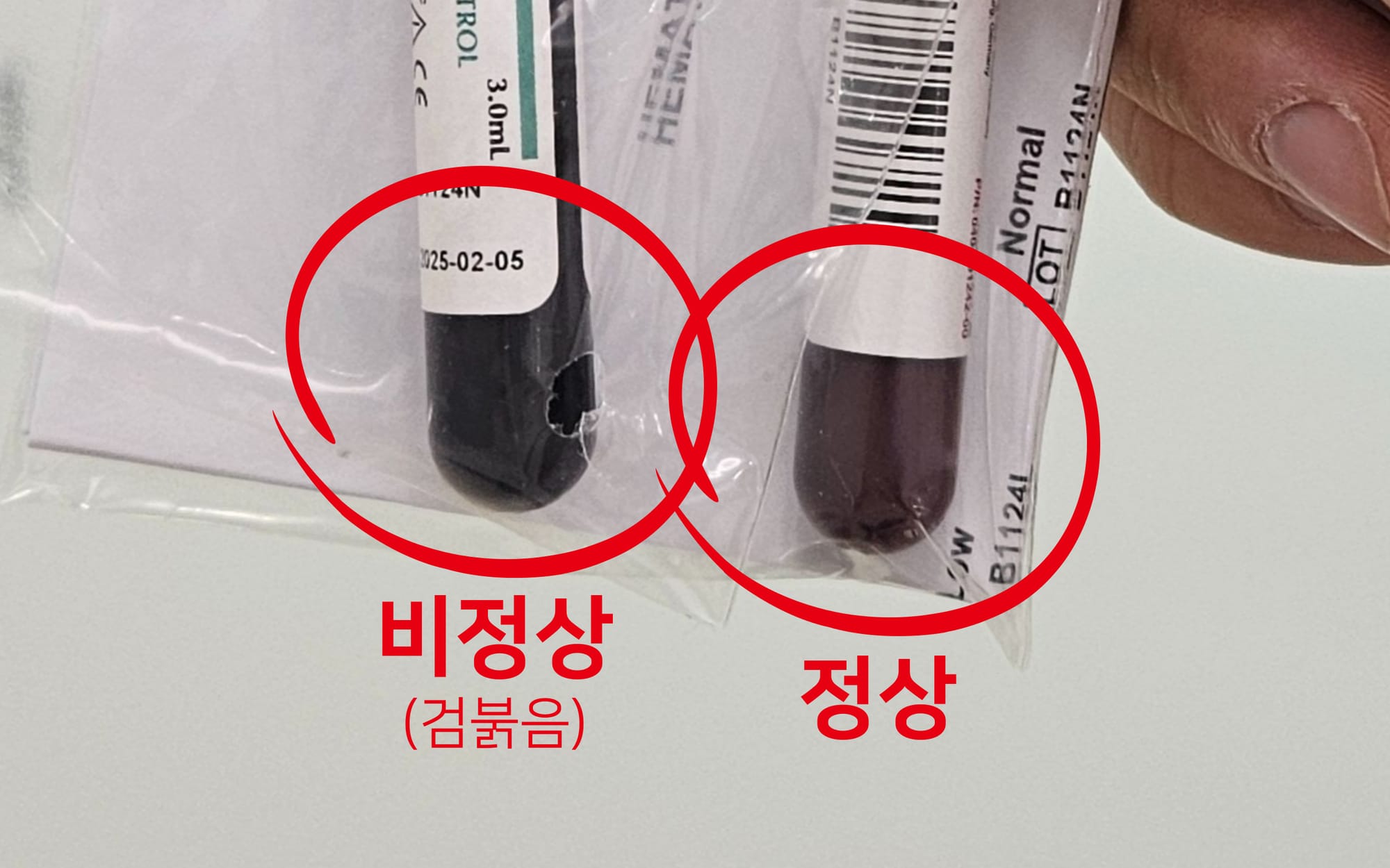 비정상 정도관리 물질과 정상 정도관리 물질 사진